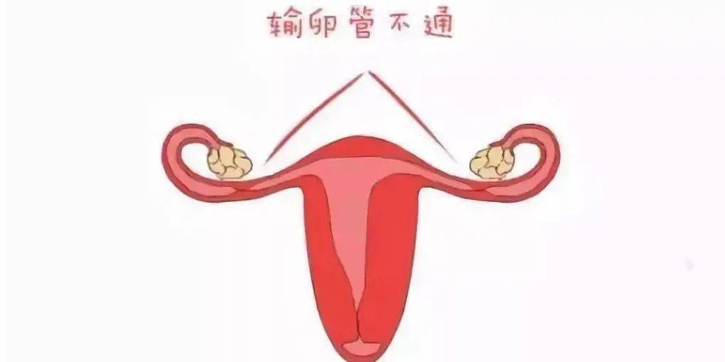 兰州天伦备孕专家:输卵管造影——更能全面了解你的输卵管!