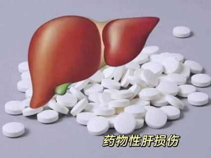 关于药物性肝损伤的那些事