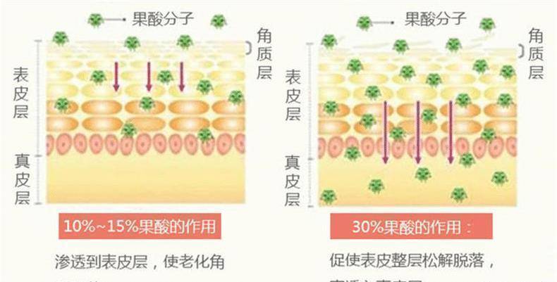建议:果酸,水杨酸,杏仁酸这类成分,能够剥除表面堆积黑色素的皮肤,让