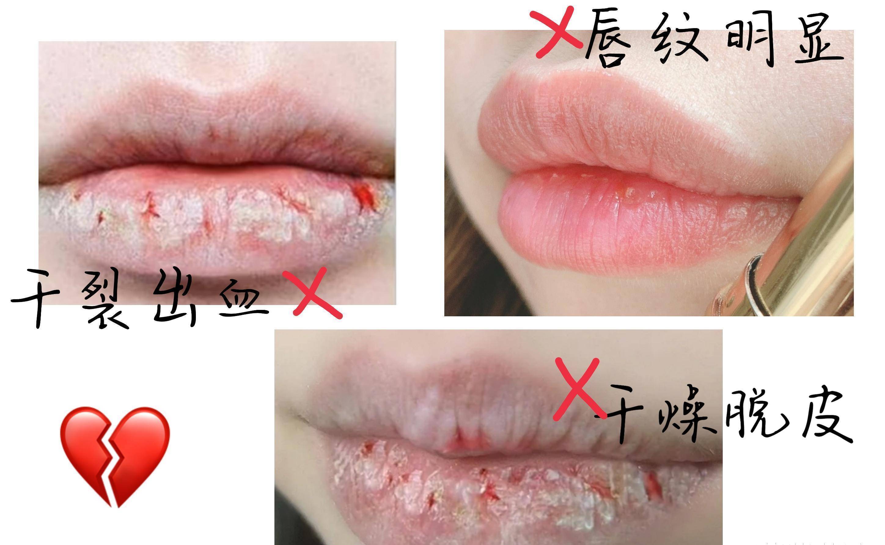 嘴唇_护理_口红