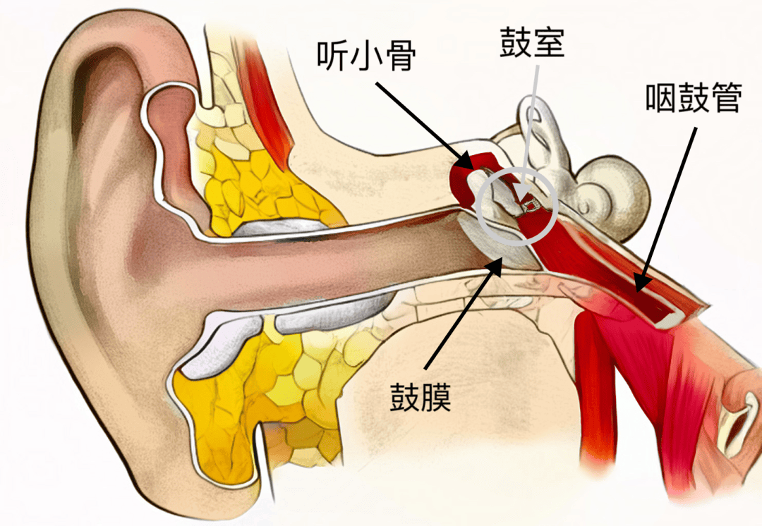 原创医大技术耳鼻咽喉科鼻咽癌放疗后耳朵听不见了