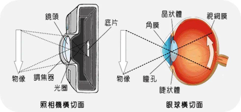 小切口白内障手术图解图片