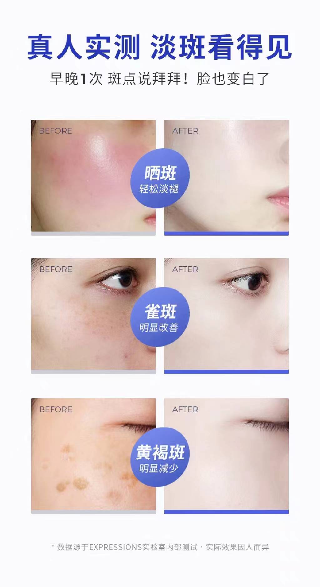 的补水养肤成分,不仅浅层的斑点淡化了,深层的暗斑也一点一点消失了