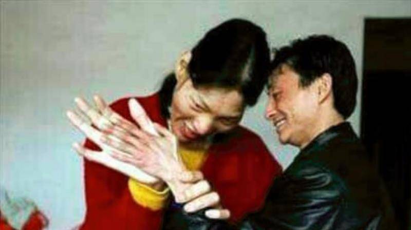 湖南女巨人:14岁身高超过姚明,18岁意外猝死,遗体至今没有下葬_曾金莲