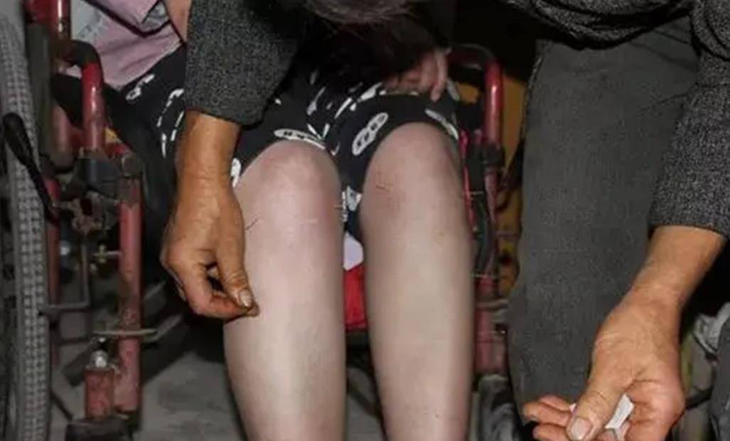 车祸成植物人,父母留下3000元后失踪,老太好心照顾17年_项菊香_女孩