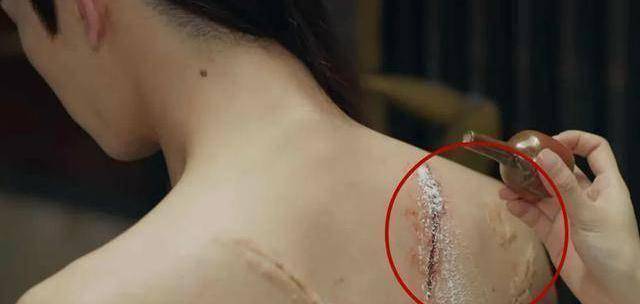 第二枪:箭伤变成疤痕在第一集中,沈锦嫁前往边境.