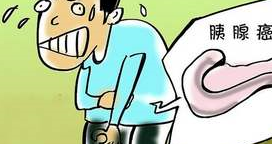 原创你知道发现率低死亡率高的胰腺癌如突发糖尿病需警惕