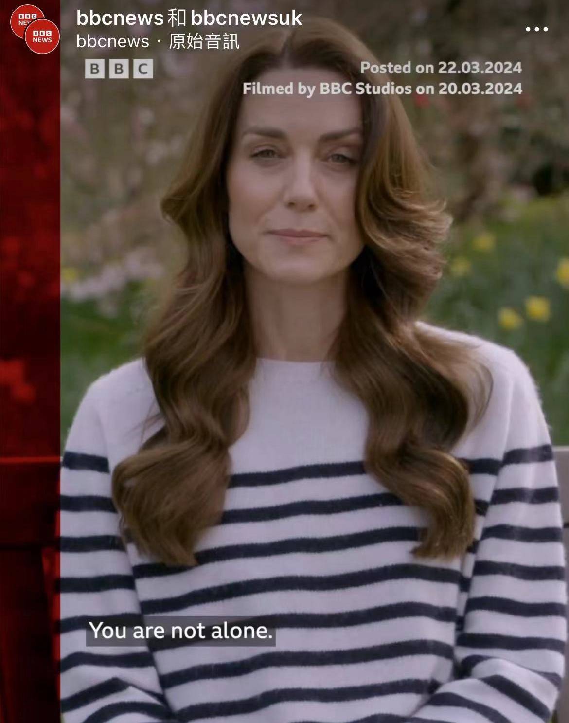 凯特王妃消瘦露面证实患癌正接受化疗透露推迟公布病情原因