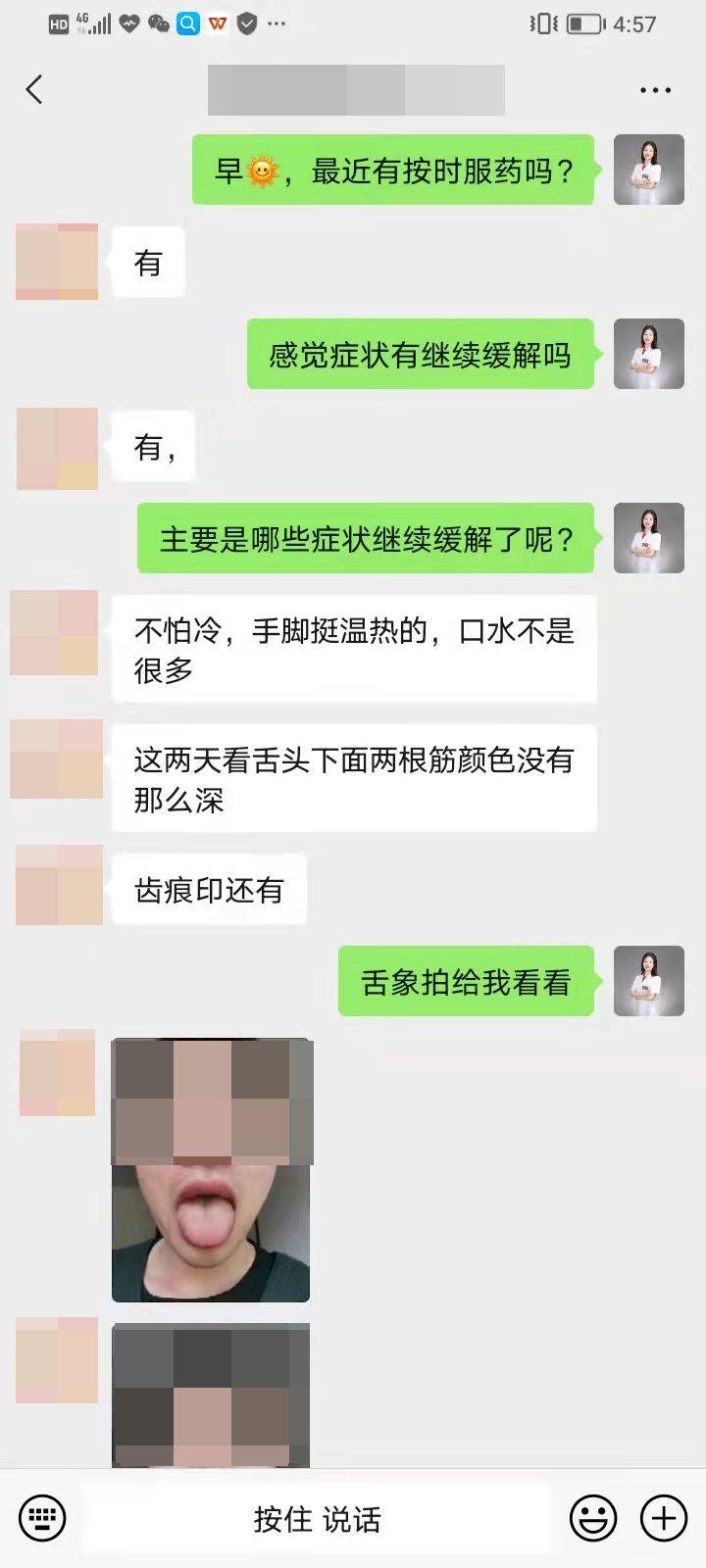 问止中医陈帅医师舌头僵硬又爱出汗怎么回事