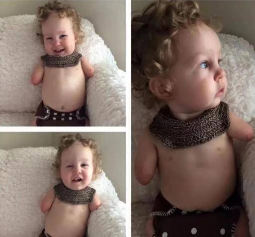 原创真实故事b超婴儿无四肢18岁妈妈拒绝堕胎如今8岁已成男子汉