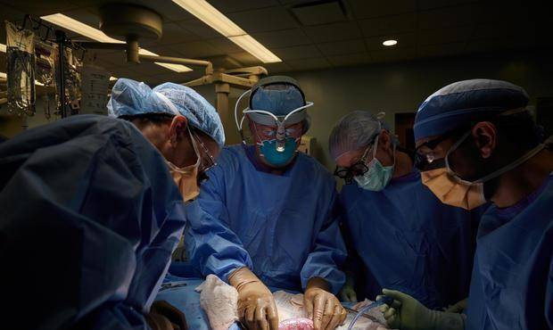 原创1984年美国母亲为救女儿为其移植了一颗狒狒心脏结果如何