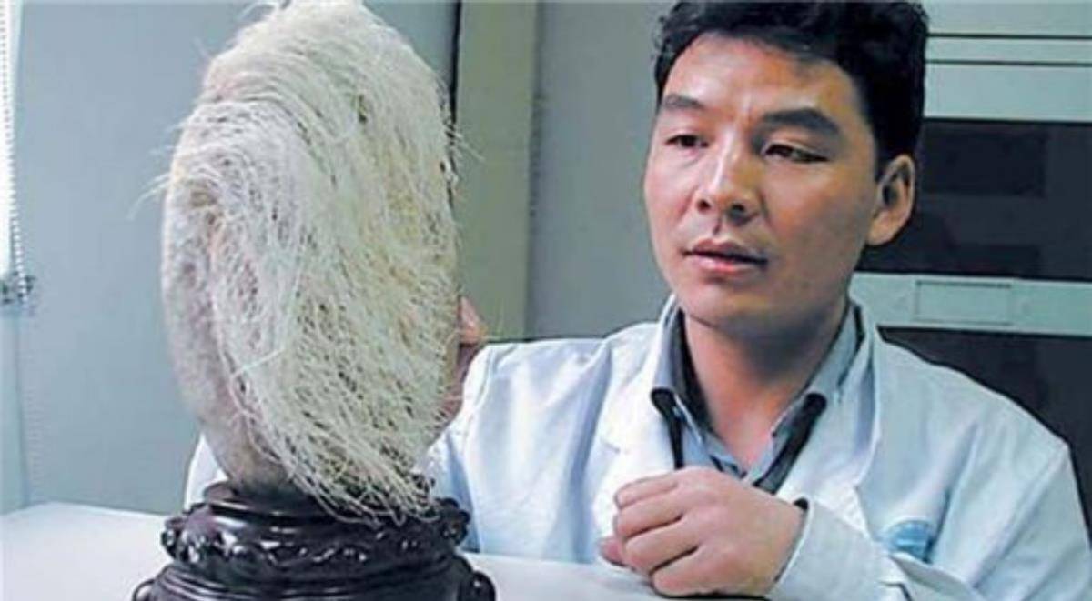 原创87年辽宁男子买下白发奇石花了18万元专家发现新物种