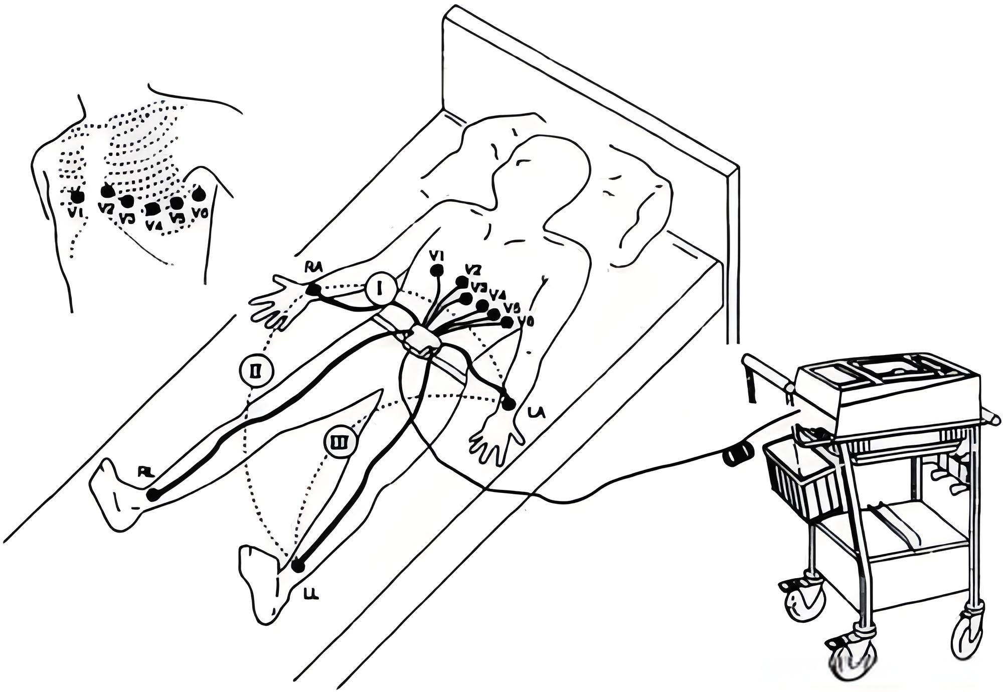 乐普心电监护仪er1和2有什么不同?