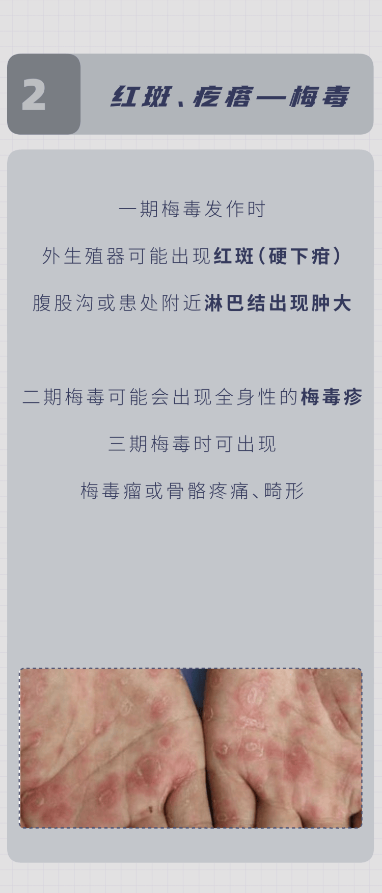 原创怎么在性生活前判断伴侣有没有性病5个检查男女都该清楚
