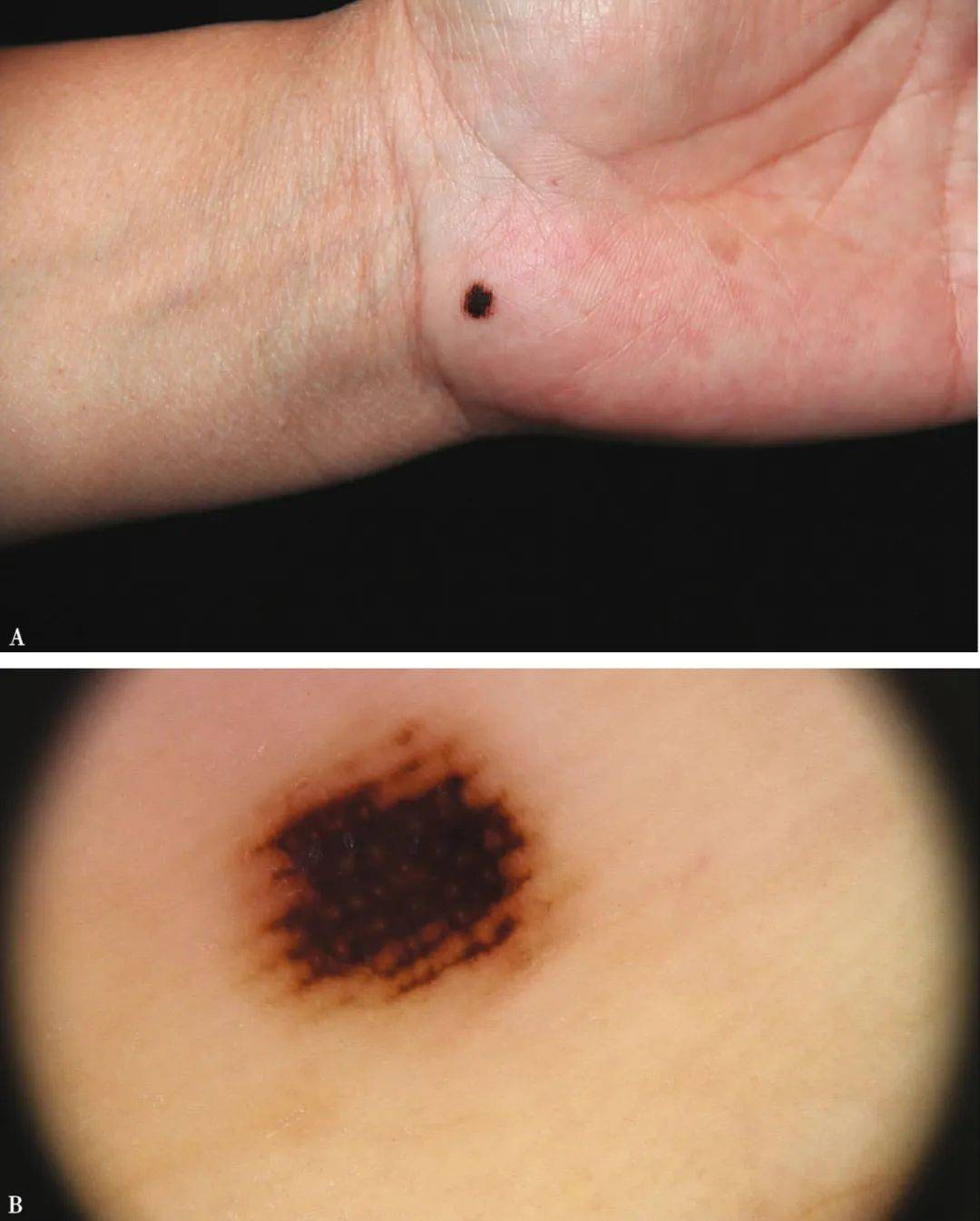 染上皮肤病到底该怎么检查皮肤镜检测过敏原检测临泉治疗皮肤病的医院