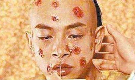 三,古代的医疗水平不高,天花等疾病肆虐.