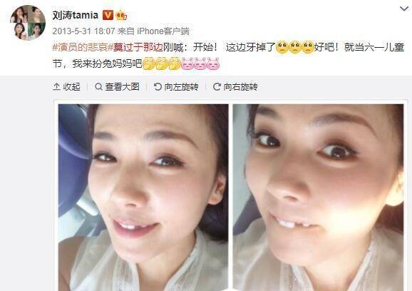 明星烤瓷牙变灾难,嘴包不住牙,嘴凸,变老,演戏难看_牙齿_观众_刘涛