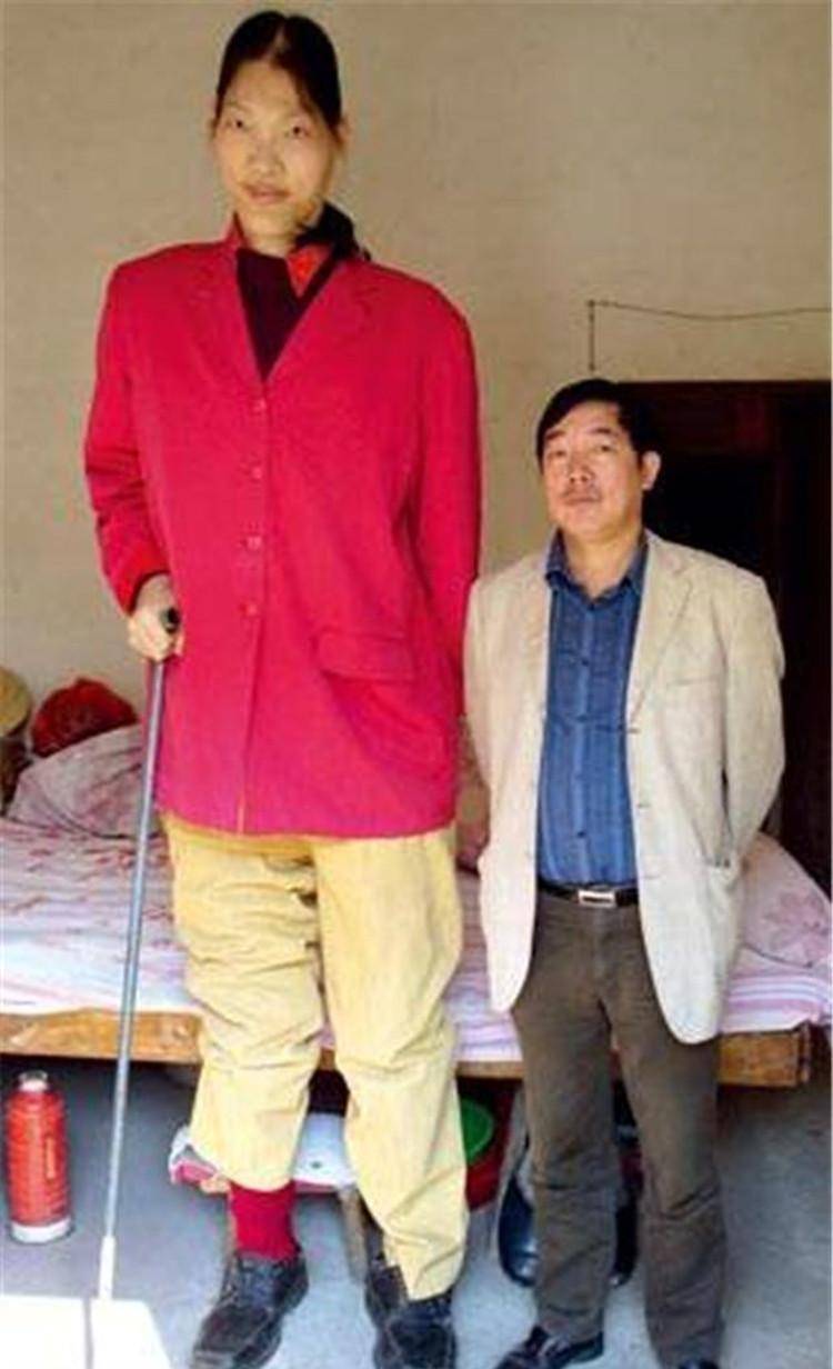 世界第一女巨人穿78码鞋子一顿吃两斤大米饭结局如何