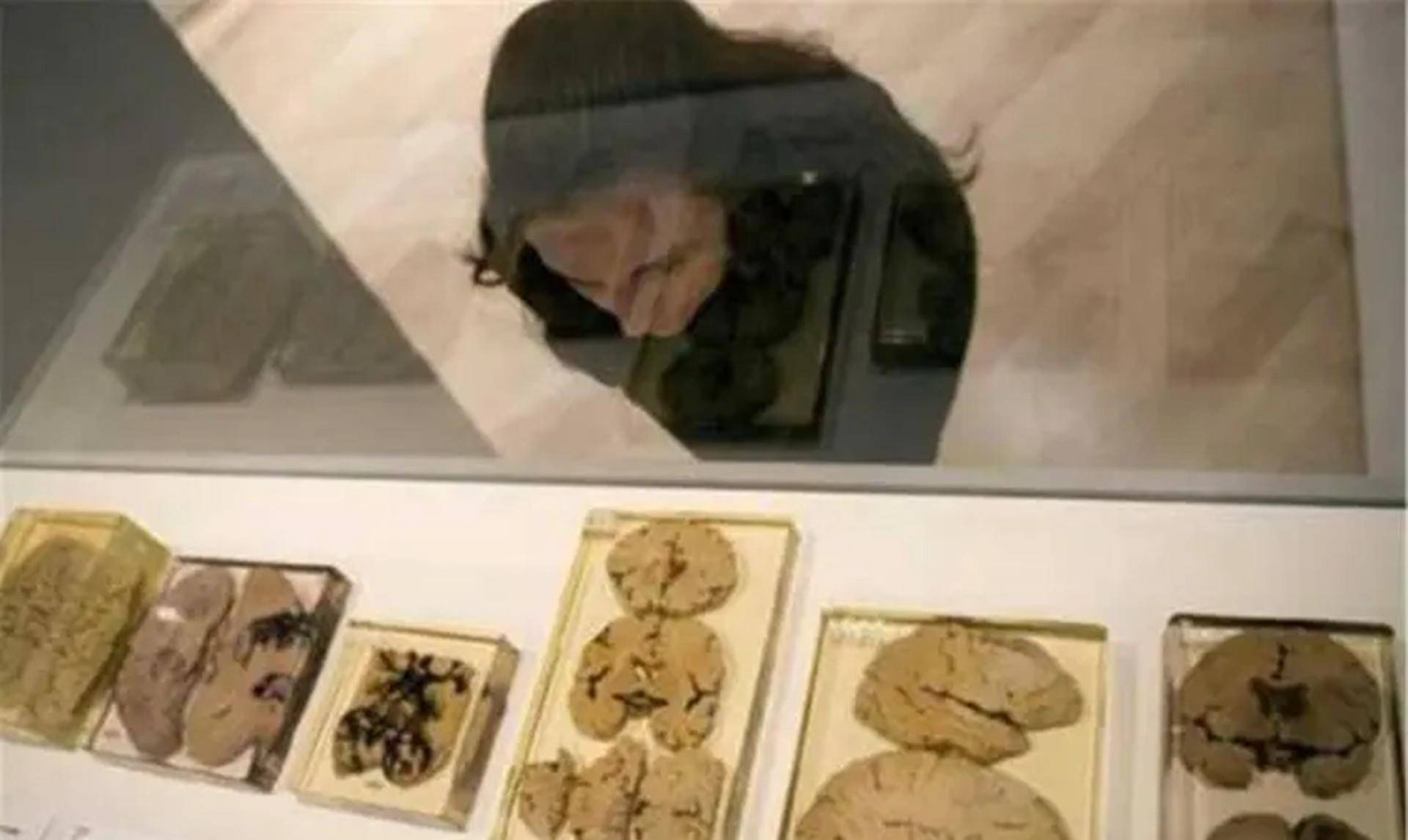 原创66年前哈维偷走爱因斯坦的大脑切成240块研究结果如何