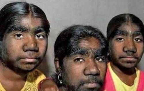 村庄,全村237人长相一模一样,专家:原因只有5个字_南村_哈拉贡_村里