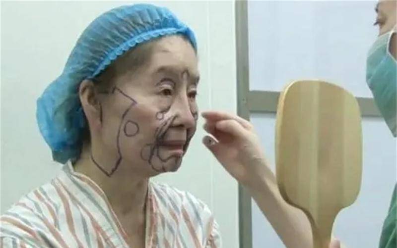 河南20岁妙龄少女,生子后瞬间变成"老太太",医生检查发现端倪_胡娟_朱