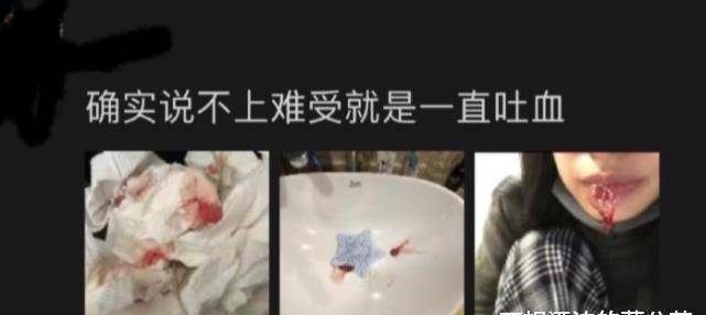 原创段小薇拔智齿脸颊肿大像发面馒头本尊晒吐血照引热议
