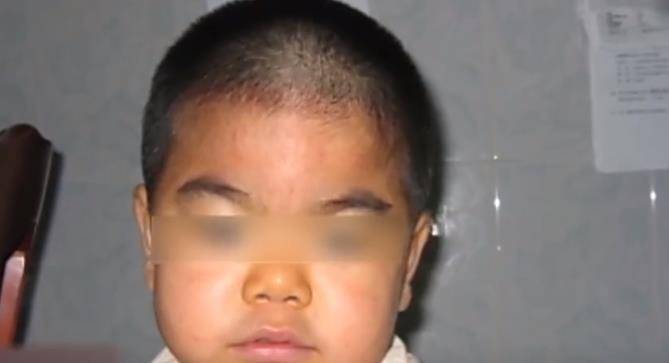 她抱着这个随时可能消失的孩子,"粘多糖病可分为七型,类型间存在差距