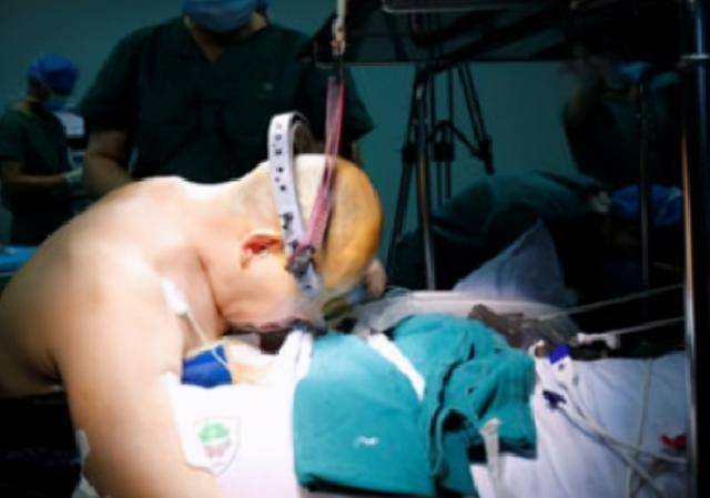 原创身体折叠28年历经四次艰难手术折叠人李华终重获新生