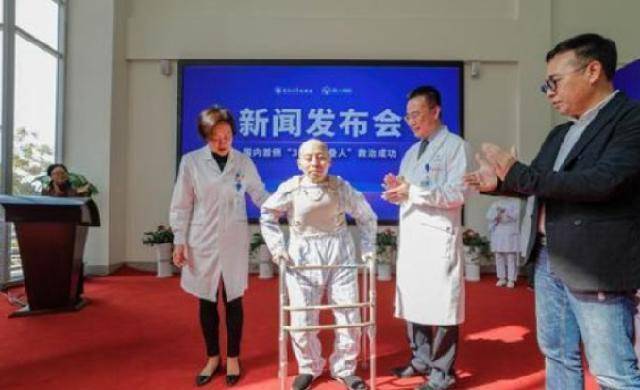 原创身体折叠28年历经四次艰难手术折叠人李华终重获新生
