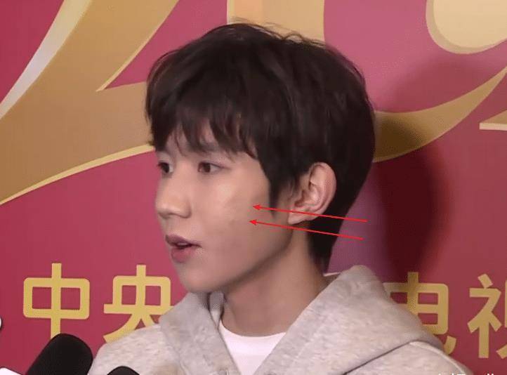 原创王源再次接受电视采访在照妖镜之下面部上痘痘很明显