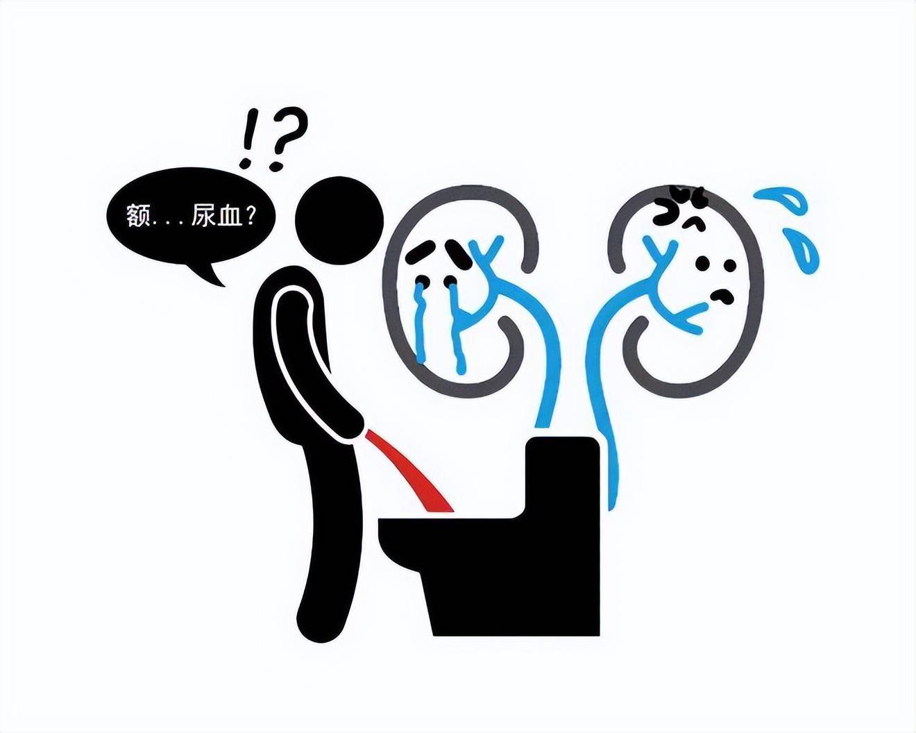 肾衰竭的元凶是谁如何守护肾脏远离肾衰竭