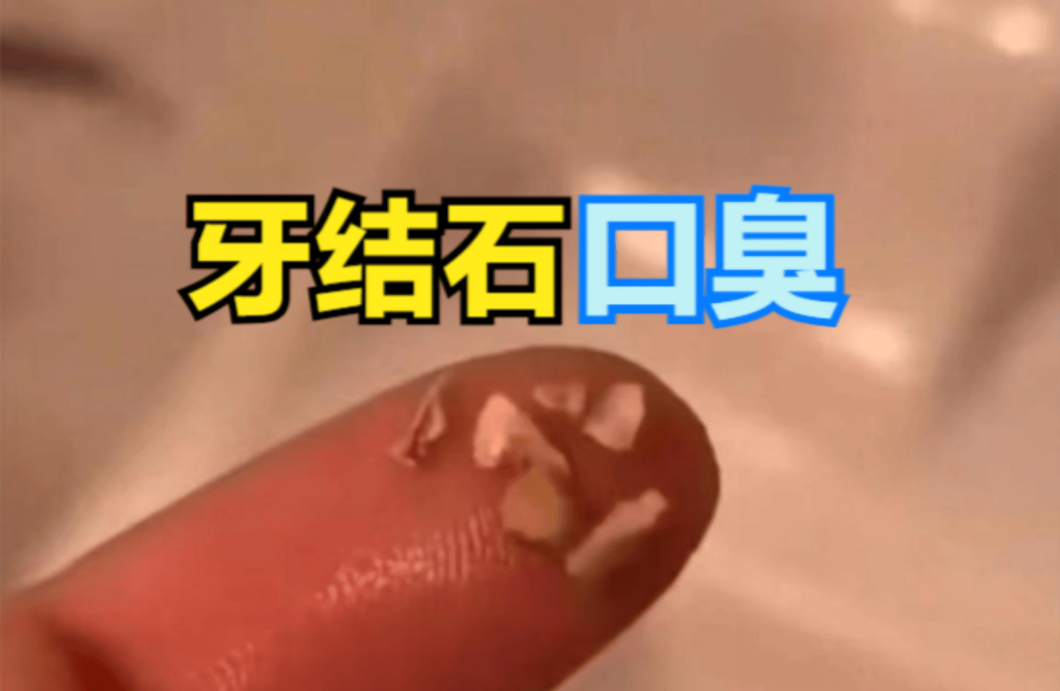 口水粘腻拉丝口臭熏人三个妙招不妨一试从此告别口臭尴尬