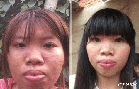 原创丑姑娘花9万元整容成功嫁富二代生下孩子后被抛弃现状如何