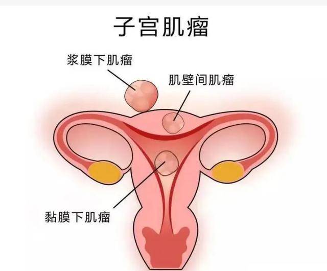 女性子宫位置真实图片