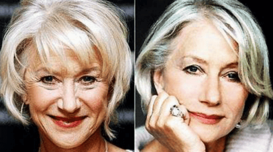 提眉术前后对比照片惊人?切眉手术多久可以恢复正常?揭秘来了!