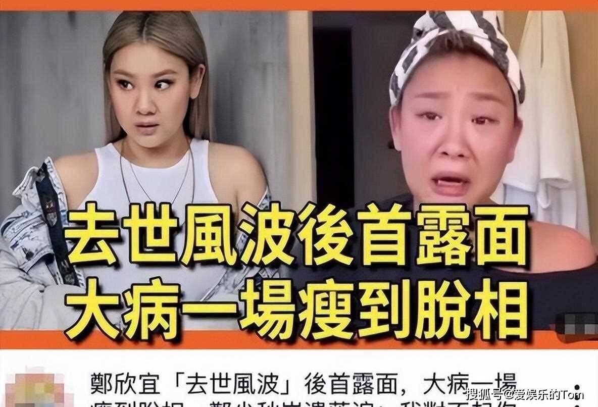 郑欣宜病危图片