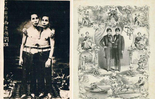 原创连体人怎样结婚生子泰国连体兄弟娶了一对姐妹生育了22个孩子