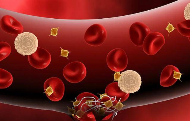 中,若这3个指标升高,不妨做进一步检查,建议了解下_体检_血液_癌症