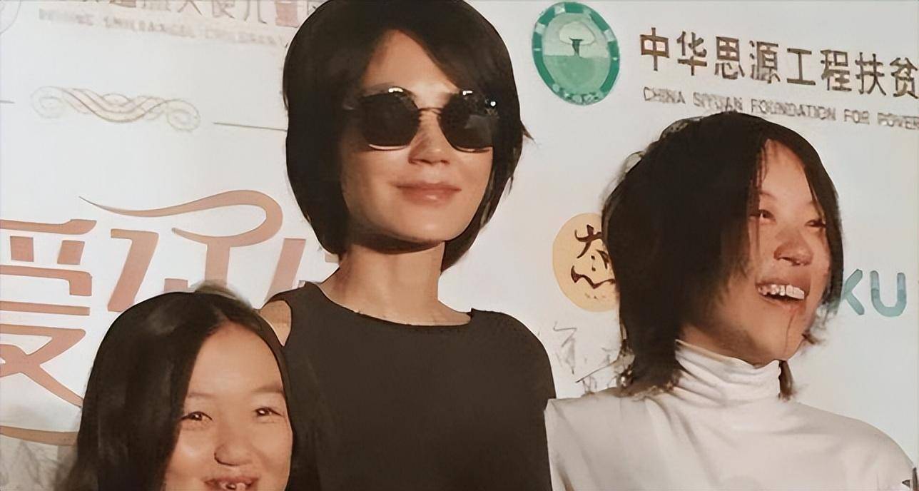 原创嘴好了脸怪了王菲花百万治疗女儿唇裂但脸是越来越奇怪了