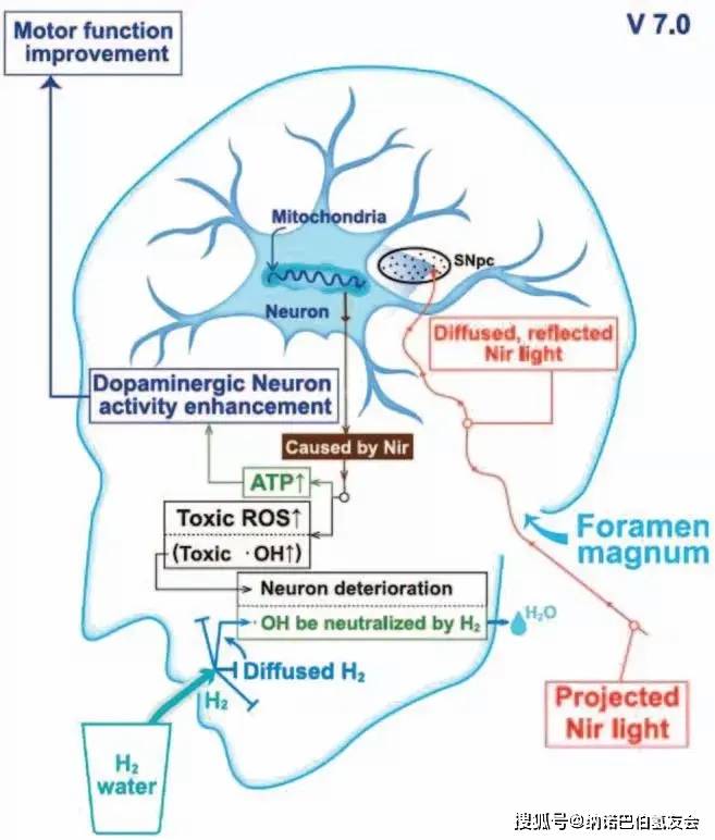 氢气改善帕金森病