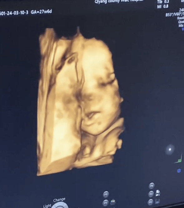 22周胎宝宝真实图片图片