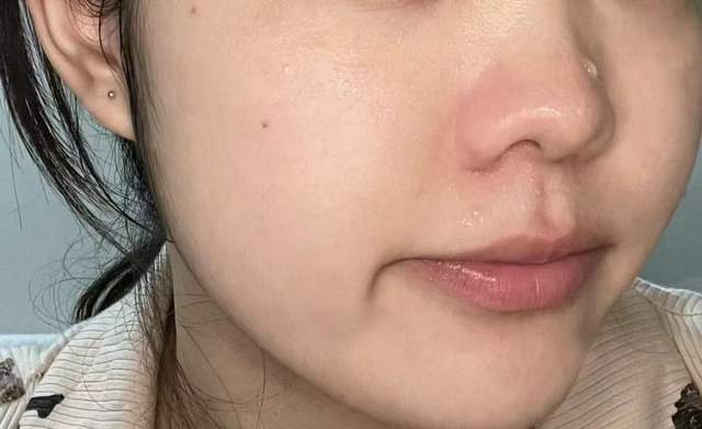 大红脸敏感肌都没了!_皮肤_感觉_情况