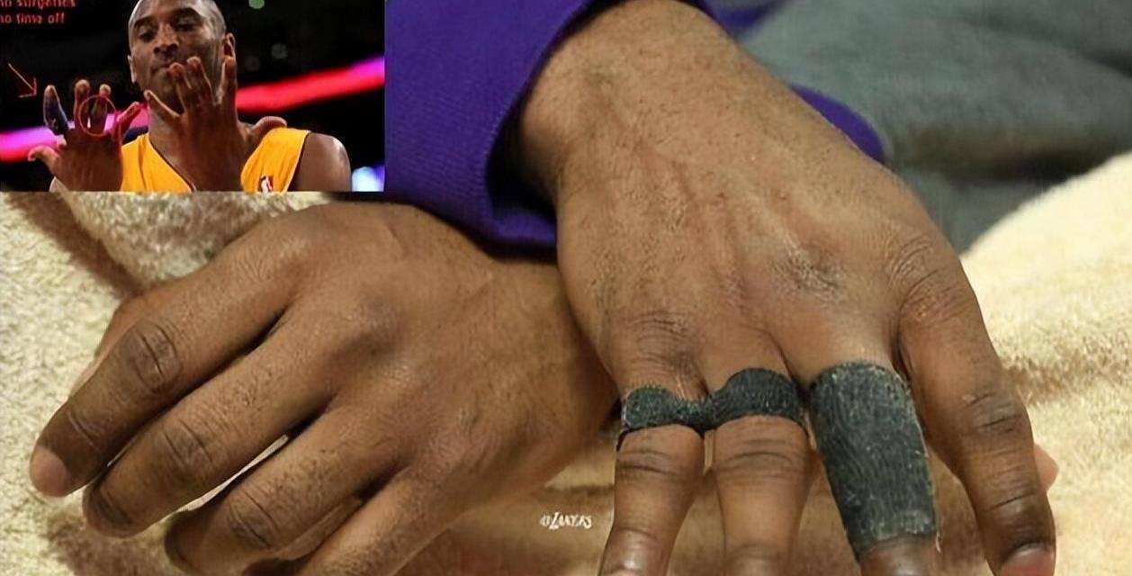 原创看看姚明的脚踝科比的手指你就会相信nba球星们为了赚钱而过度