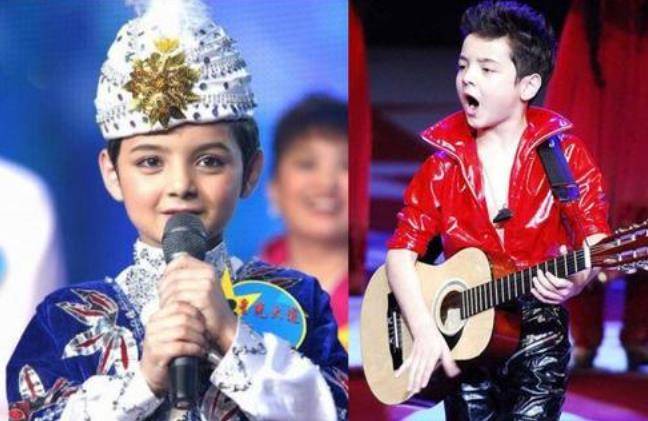 原创有种整容叫阿尔法植发秃顶时被嫌丑如今秒变欧美混血王子