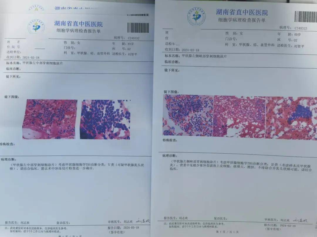 甲状腺报告单图片