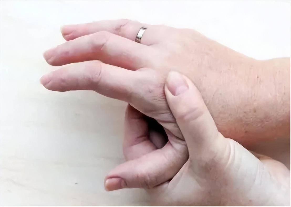 女子确诊肺癌后泣不成声只因手指的这几个预警信号自己没注意