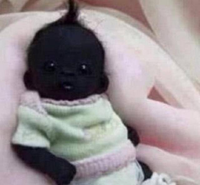 被早产的"世界最黑"婴儿,若是真的存在,如今怎么样了_孩子_照片_皮肤