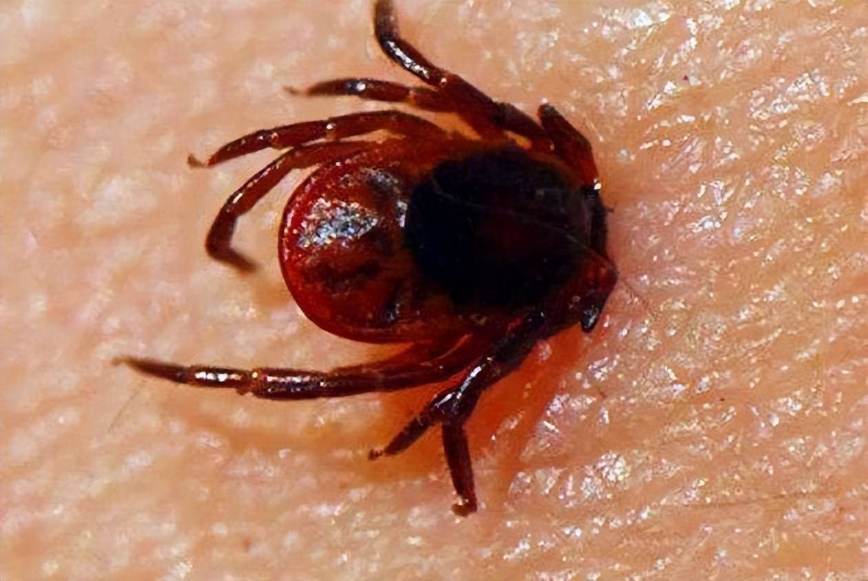 原创            大姐先被五步蛇咬，后被蜱虫叮！春季踏青哪些地方要少去？