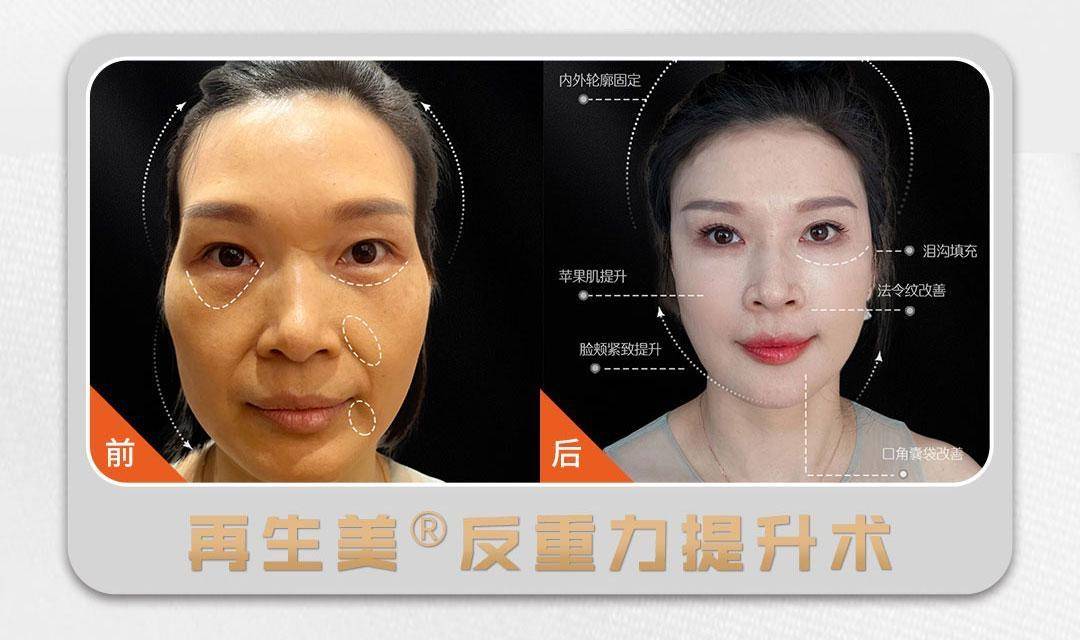 九院轻医美张文博医生综上所述,张文博医生无疑是整形外科领域的椅换