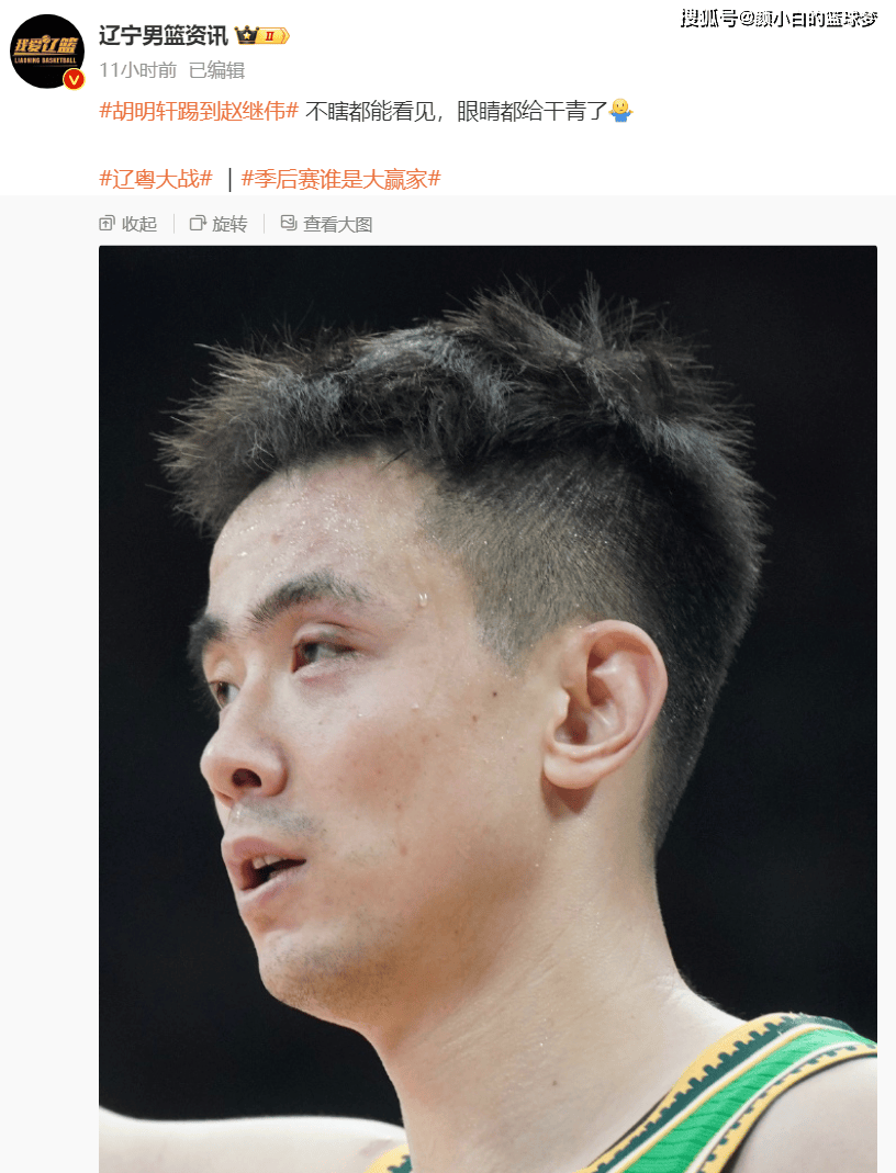 赵继伟眼睛肿胀无比:大v盼联盟追加处罚 晒小胡多次伤人瞬间吐槽